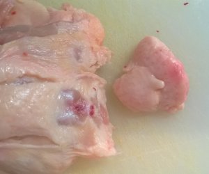 Levágom a zsírmirigyet